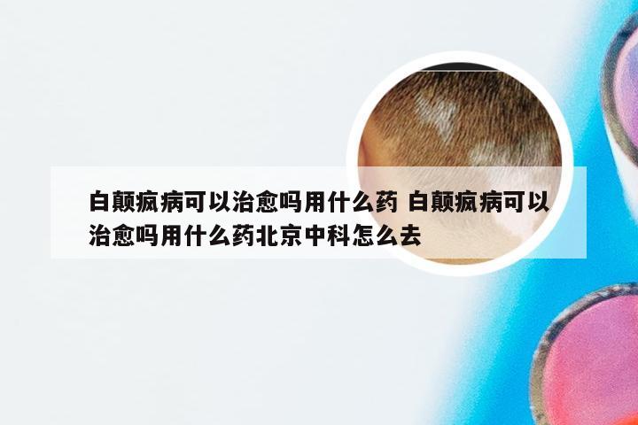 白颠疯病可以治愈吗用什么药 白颠疯病可以治愈吗用什么药北京中科怎么去
