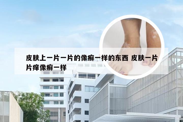 皮肤上一片一片的像癣一样的东西 皮肤一片片痒像癣一样