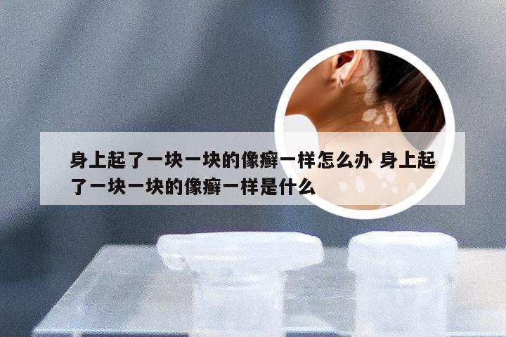 身上起了一块一块的像癣一样怎么办 身上起了一块一块的像癣一样是什么