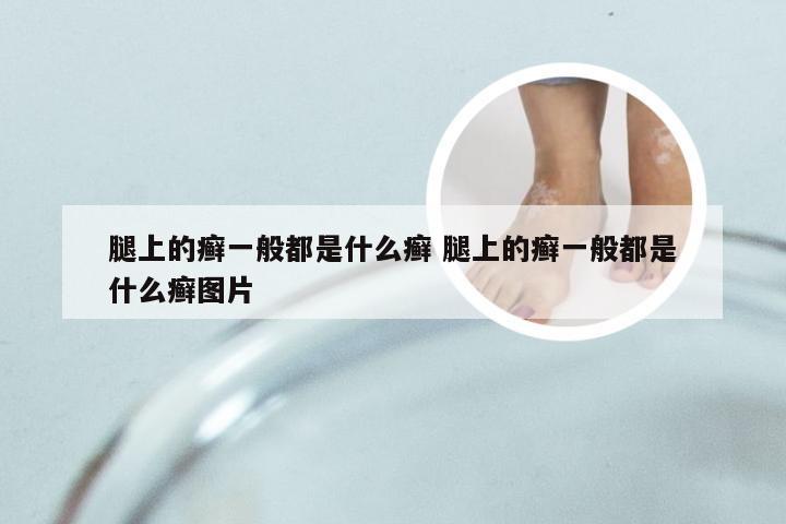 腿上的癣一般都是什么癣 腿上的癣一般都是什么癣图片