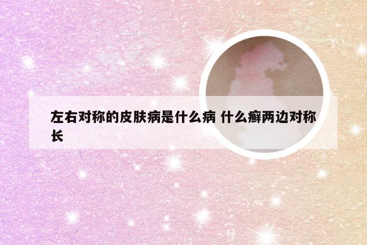 左右对称的皮肤病是什么病 什么癣两边对称长