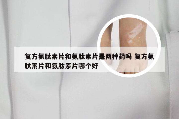 复方氨肽素片和氨肽素片是两种药吗 复方氨肽素片和氨肽素片哪个好