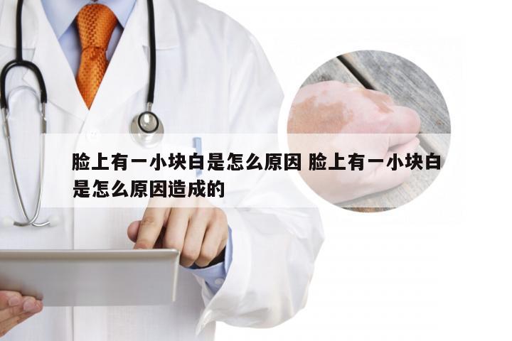 脸上有一小块白是怎么原因 脸上有一小块白是怎么原因造成的