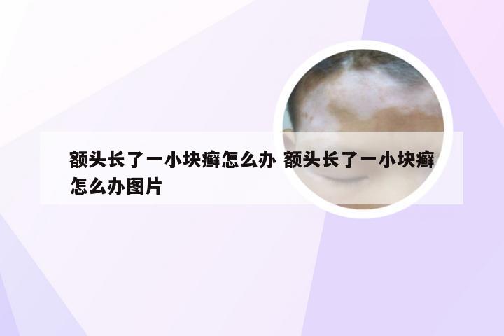 额头长了一小块癣怎么办 额头长了一小块癣怎么办图片