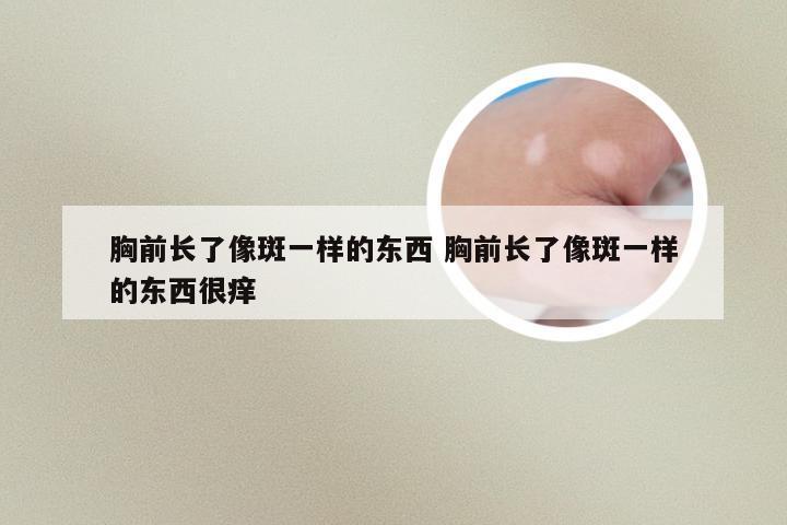 胸前长了像斑一样的东西 胸前长了像斑一样的东西很痒