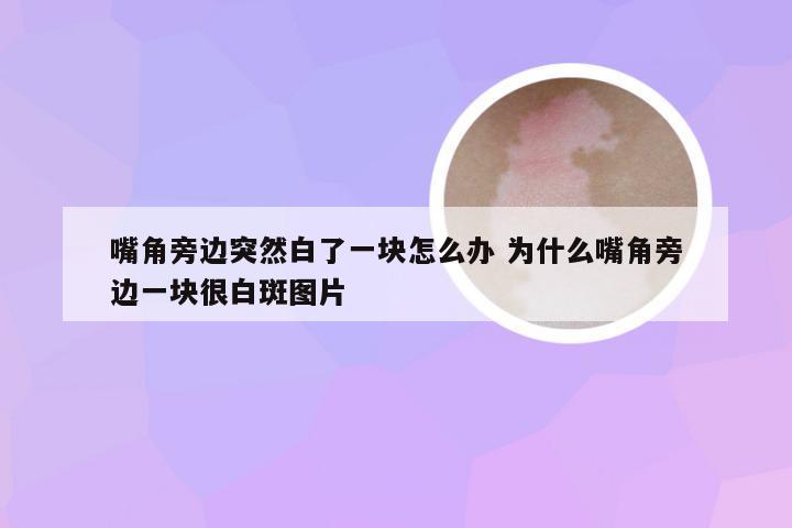 嘴角旁边突然白了一块怎么办 为什么嘴角旁边一块很白斑图片