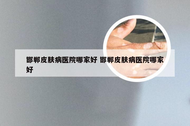 邯郸皮肤病医院哪家好 邯郸皮肤病医院哪家好