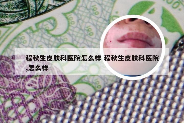 程秋生皮肤科医院怎么样 程秋生皮肤科医院,怎么样