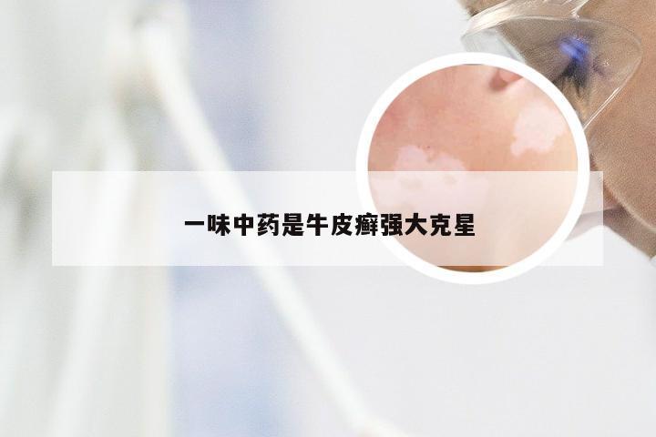 一味中药是牛皮癣强大克星