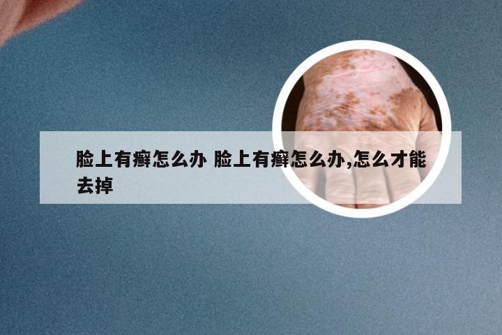 脸上有癣怎么办 脸上有癣怎么办,怎么才能去掉