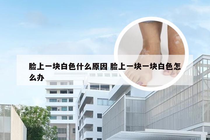 脸上一块白色什么原因 脸上一块一块白色怎么办