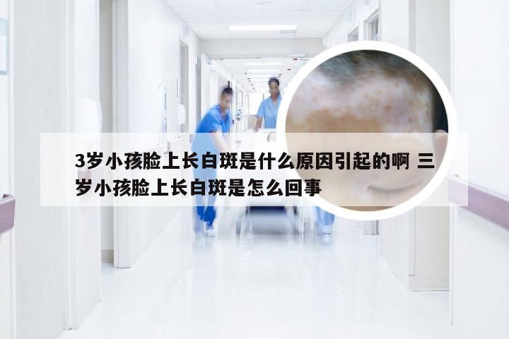 3岁小孩脸上长白斑是什么原因引起的啊 三岁小孩脸上长白斑是怎么回事