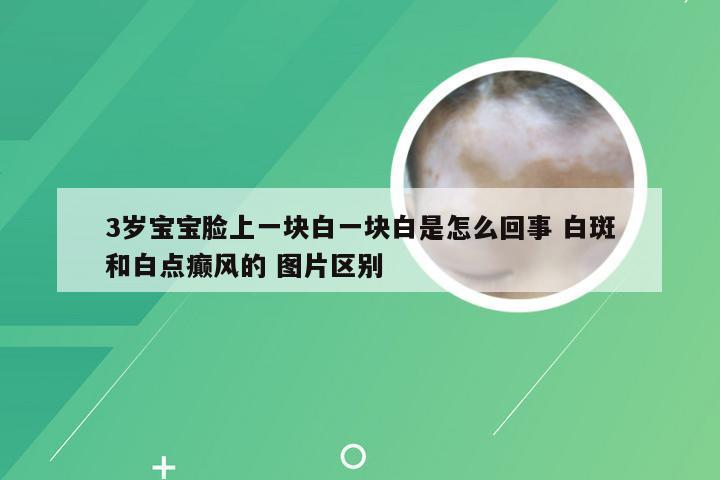 3岁宝宝脸上一块白一块白是怎么回事 白斑和白点癫风的 图片区别