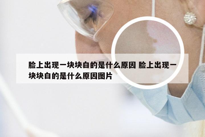 脸上出现一块块白的是什么原因 脸上出现一块块白的是什么原因图片