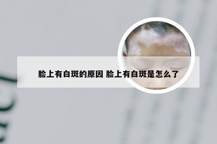 脸上有白斑的原因 脸上有白斑是怎么了