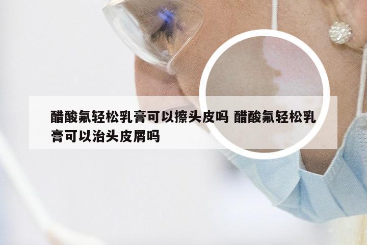 醋酸氟轻松乳膏可以擦头皮吗 醋酸氟轻松乳膏可以治头皮屑吗