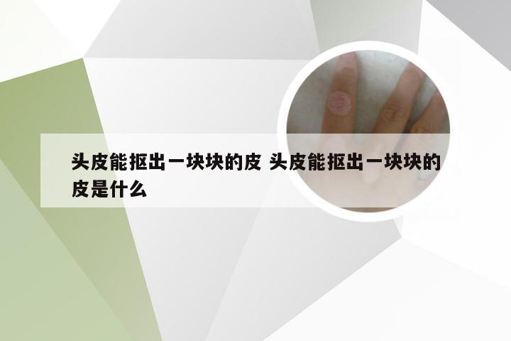 头皮能抠出一块块的皮 头皮能抠出一块块的皮是什么