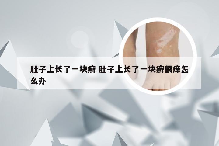 肚子上长了一块癣 肚子上长了一块癣很痒怎么办