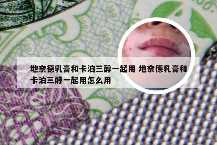 地奈德乳膏和卡泊三醇一起用 地奈德乳膏和卡泊三醇一起用怎么用