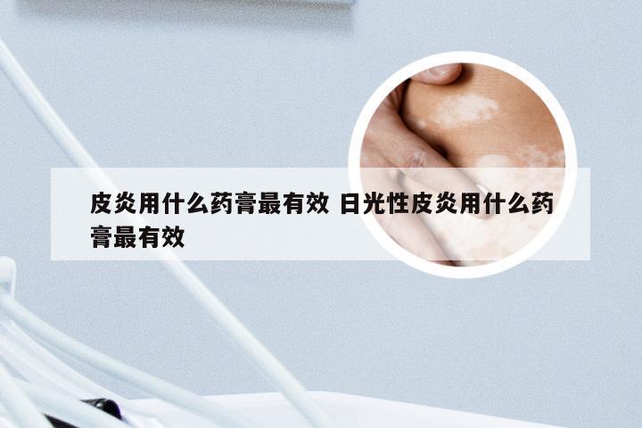 皮炎用什么药膏最有效 日光性皮炎用什么药膏最有效