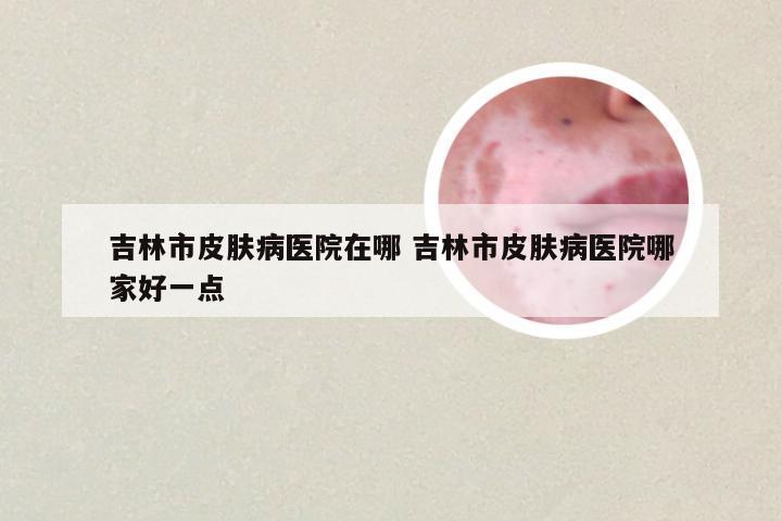 吉林市皮肤病医院在哪 吉林市皮肤病医院哪家好一点