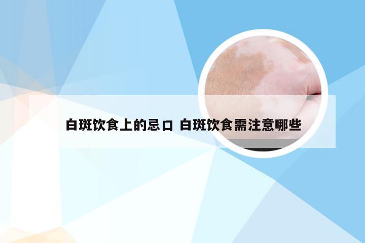 白斑饮食上的忌口 白斑饮食需注意哪些