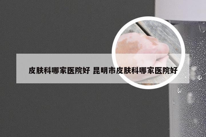 皮肤科哪家医院好 昆明市皮肤科哪家医院好