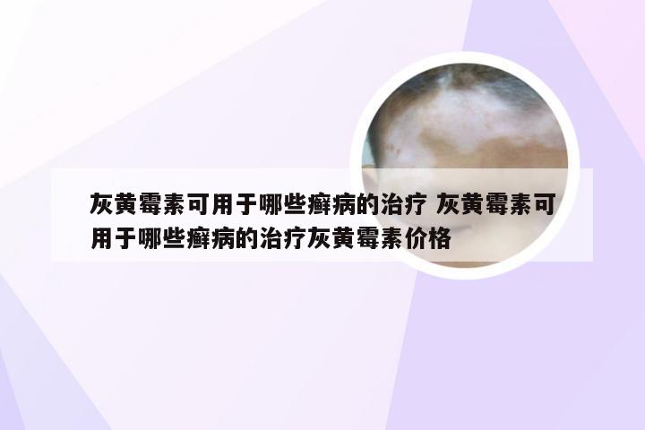 灰黄霉素可用于哪些癣病的治疗 灰黄霉素可用于哪些癣病的治疗灰黄霉素价格