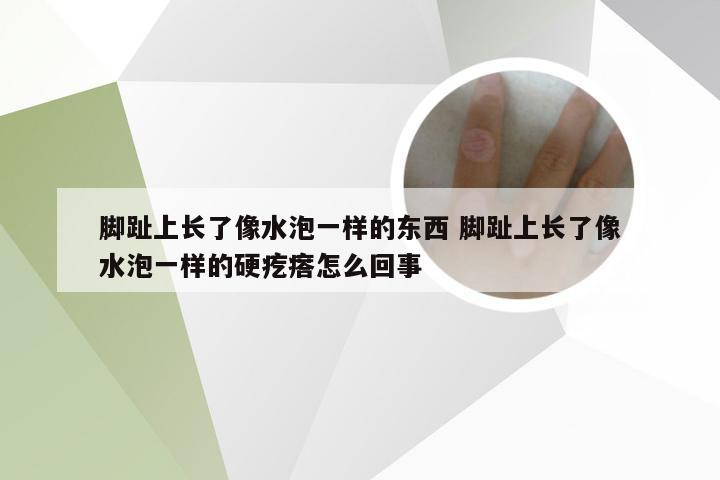 脚趾上长了像水泡一样的东西 脚趾上长了像水泡一样的硬疙瘩怎么回事