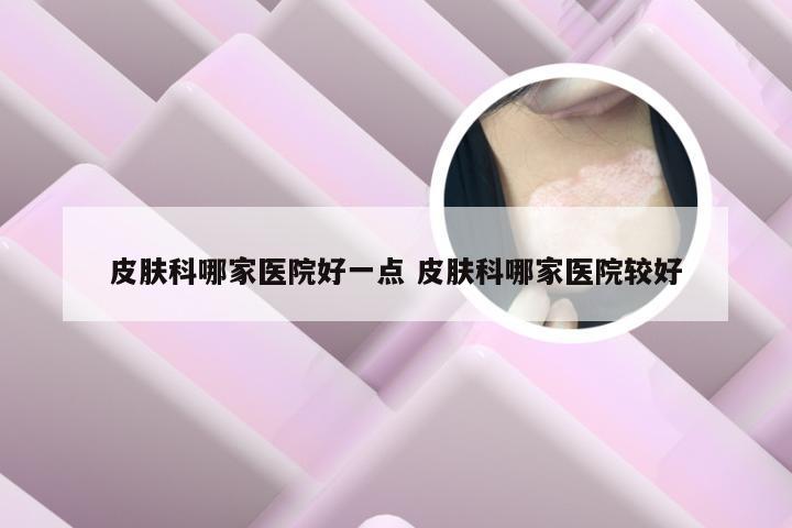 皮肤科哪家医院好一点 皮肤科哪家医院较好