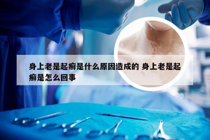 身上老是起癣是什么原因造成的 身上老是起癣是怎么回事