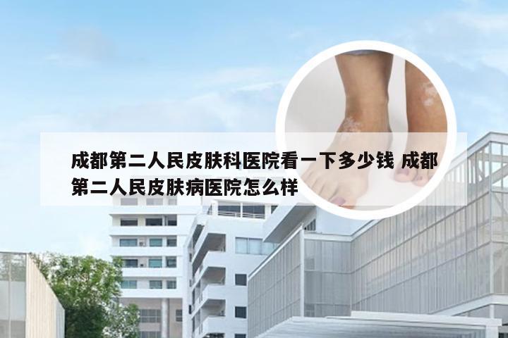 成都第二人民皮肤科医院看一下多少钱 成都第二人民皮肤病医院怎么样