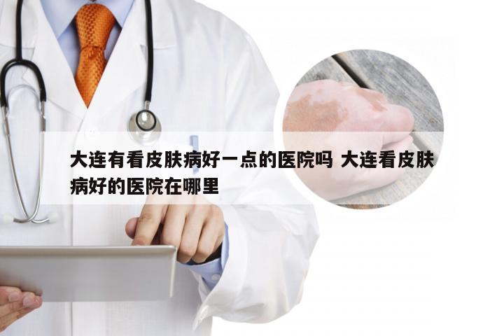 大连有看皮肤病好一点的医院吗 大连看皮肤病好的医院在哪里