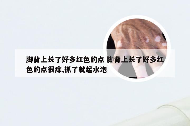 脚背上长了好多红色的点 脚背上长了好多红色的点很痒,抓了就起水泡