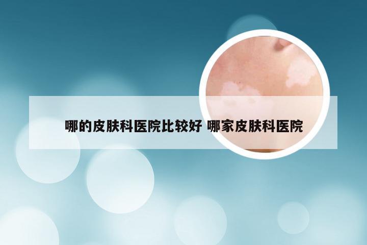 哪的皮肤科医院比较好 哪家皮肤科医院