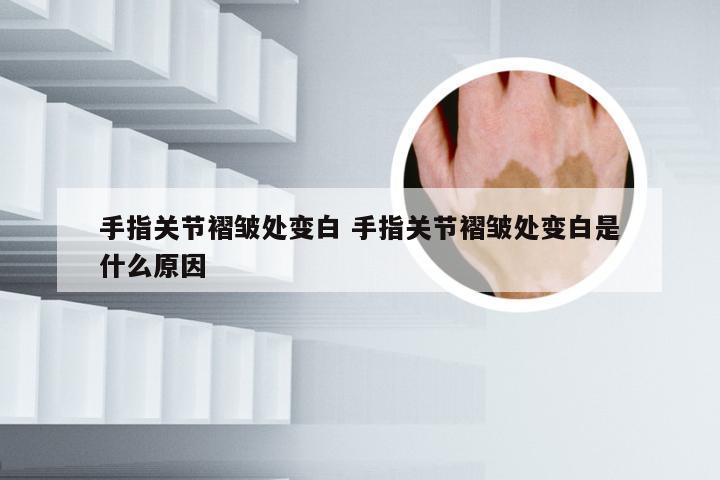 手指关节褶皱处变白 手指关节褶皱处变白是什么原因