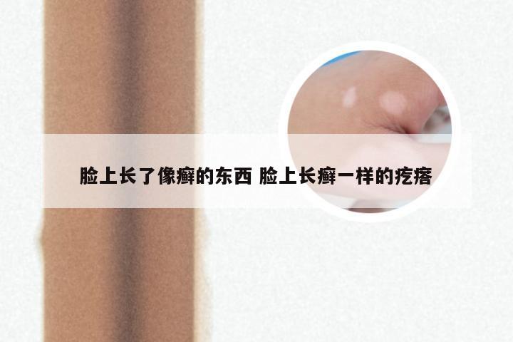 脸上长了像癣的东西 脸上长癣一样的疙瘩