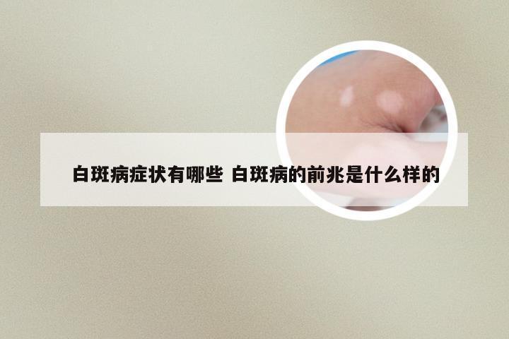 白斑病症状有哪些 白斑病的前兆是什么样的