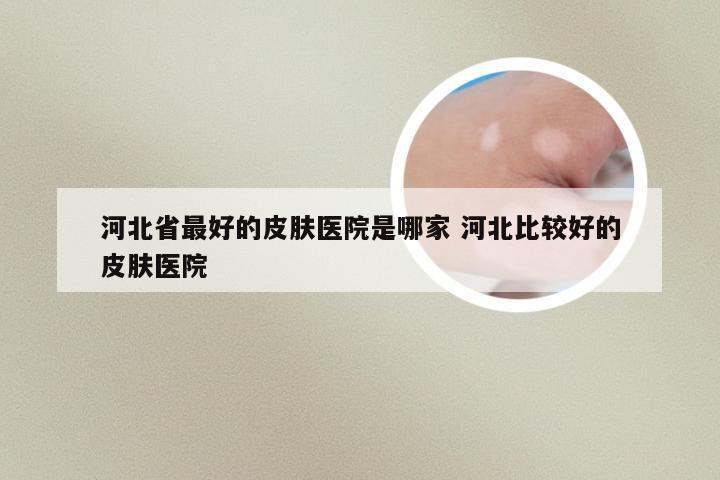 河北省最好的皮肤医院是哪家 河北比较好的皮肤医院