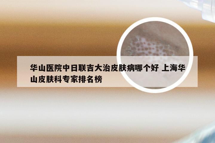 华山医院中日联吉大治皮肤病哪个好 上海华山皮肤科专家排名榜