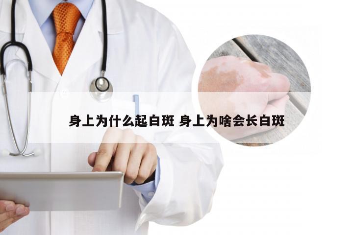 身上为什么起白斑 身上为啥会长白斑