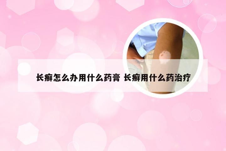长癣怎么办用什么药膏 长癣用什么药治疗