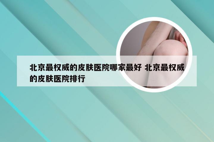 北京最权威的皮肤医院哪家最好 北京最权威的皮肤医院排行