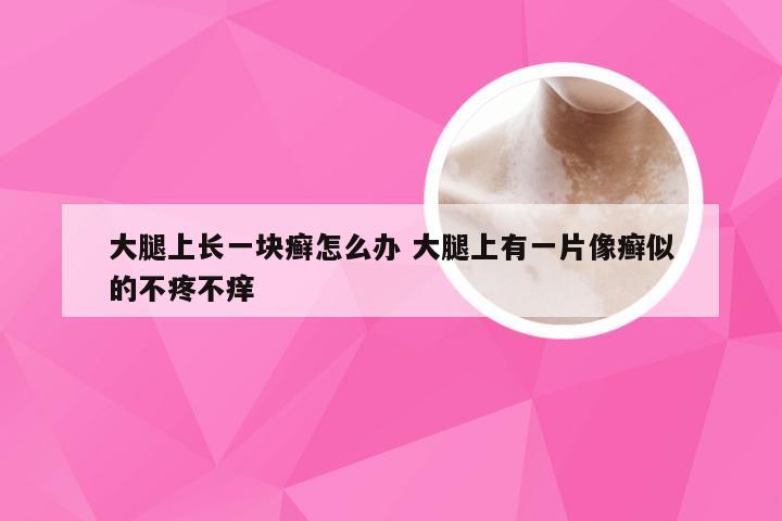 大腿上长一块癣怎么办 大腿上有一片像癣似的不疼不痒
