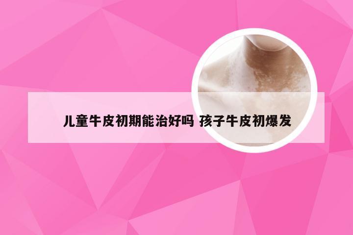 儿童牛皮初期能治好吗 孩子牛皮初爆发