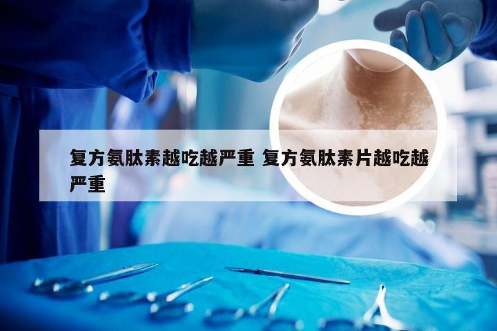 复方氨肽素越吃越严重 复方氨肽素片越吃越严重