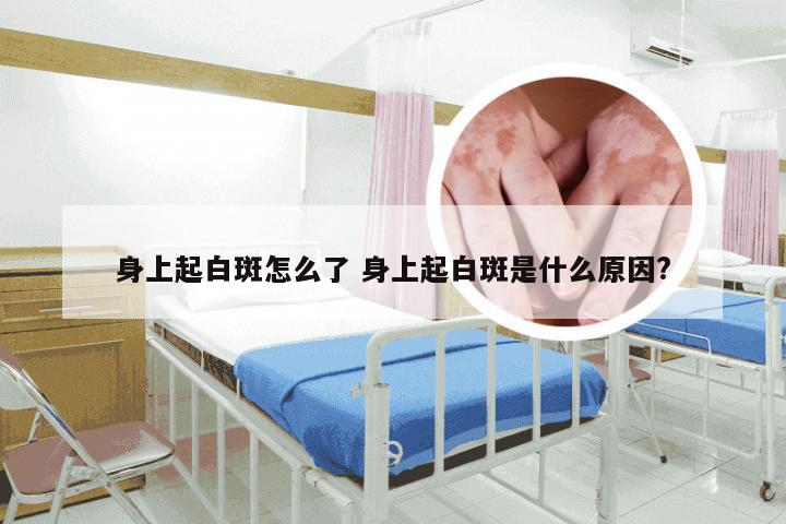 身上起白斑怎么了 身上起白斑是什么原因?