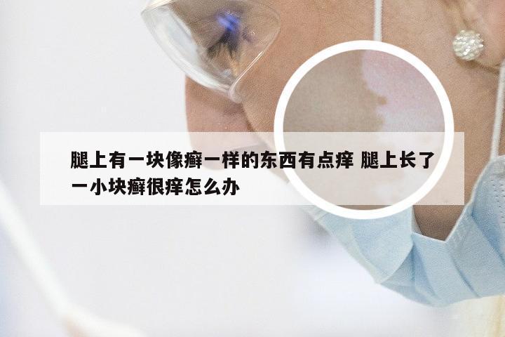 腿上有一块像癣一样的东西有点痒 腿上长了一小块癣很痒怎么办