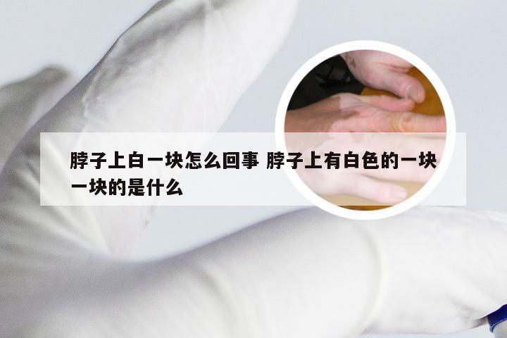 脖子上白一块怎么回事 脖子上有白色的一块一块的是什么