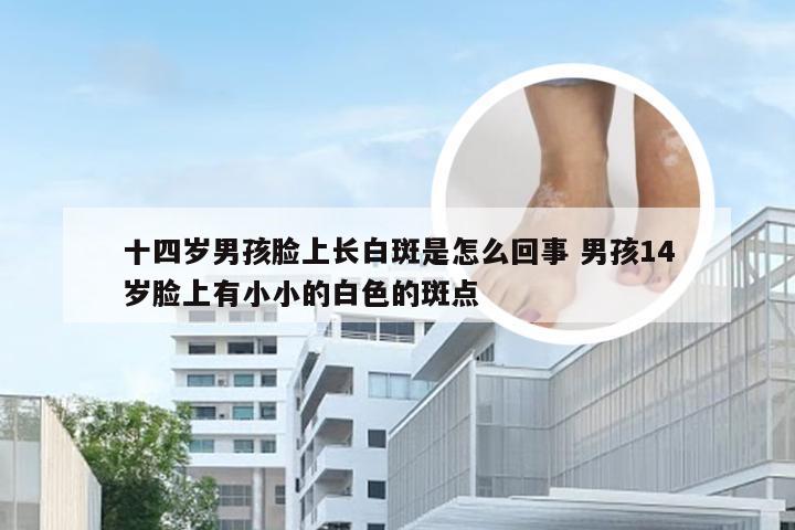 十四岁男孩脸上长白斑是怎么回事 男孩14岁脸上有小小的白色的斑点